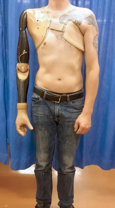 Illustration for article titled Este nuevo brazo robótico detecta las señales nerviosas de la espina dorsal para moverse como uno real